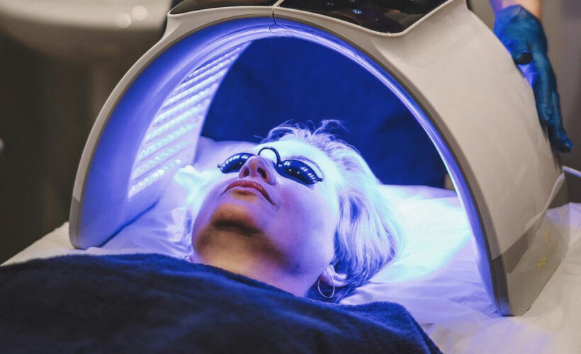 UVB Therapy