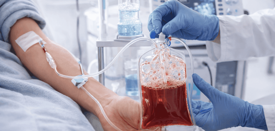 Practitioner holding ozonated blood IV bag connected to patient's arm during blood ozone therapy session