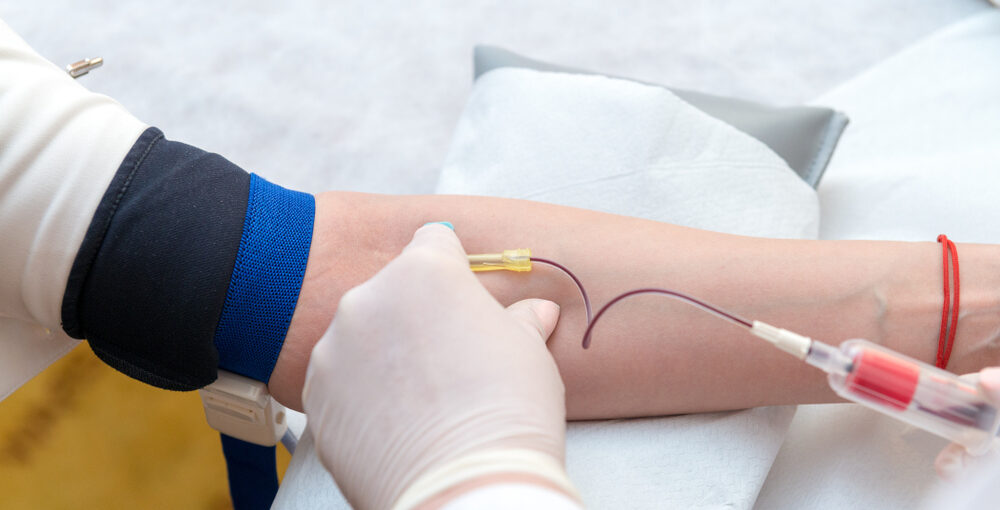 Gloved practitioner drawing blood from patient's arm as the first step of an ozone therapy detox autohemotherapy session