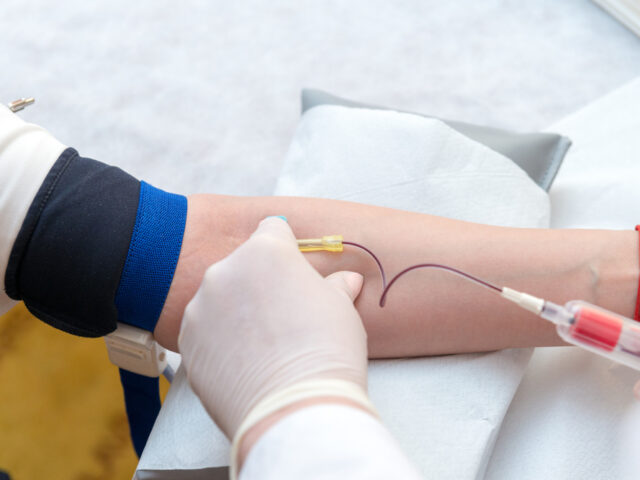 Does Ozone Therapy Actually Help Your Body Detox? Here Is What Happens