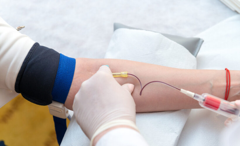 Gloved practitioner drawing blood from patient's arm as the first step of an ozone therapy detox autohemotherapy session