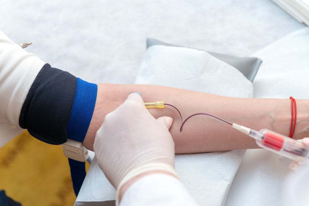 Gloved practitioner drawing blood from patient's arm as the first step of an ozone therapy detox autohemotherapy session