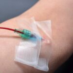 Close-up of IV catheter taped to patient's arm used during ozone therapy immune system treatment session