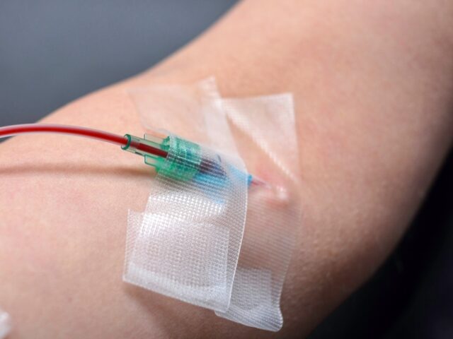 Ozone Therapy Immune System: How It Works at the Cell Level