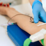 Gloved practitioner adjusting IV needle in patient's forearm during an ozone therapy for fatigue autohemotherapy session