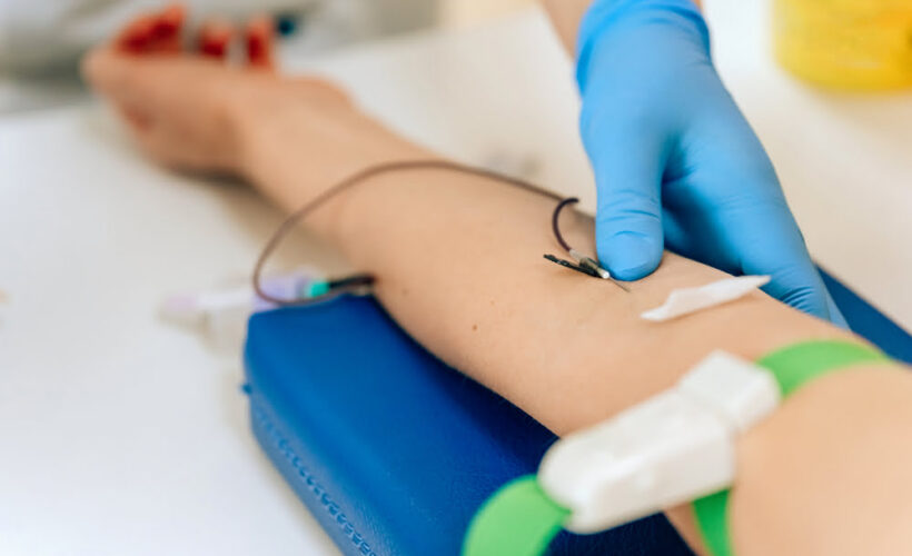 Gloved practitioner adjusting IV needle in patient's forearm during an ozone therapy for fatigue autohemotherapy session